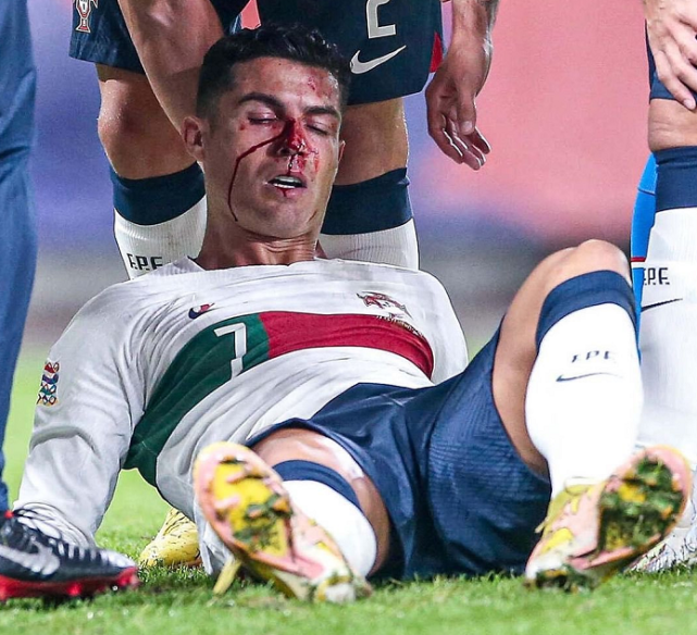 星空娱乐 -包含意大利杯今晚走向成谜；多伦多猛龙单刀错失；赛场秩序良好；赛程密集仍需轮换的词条